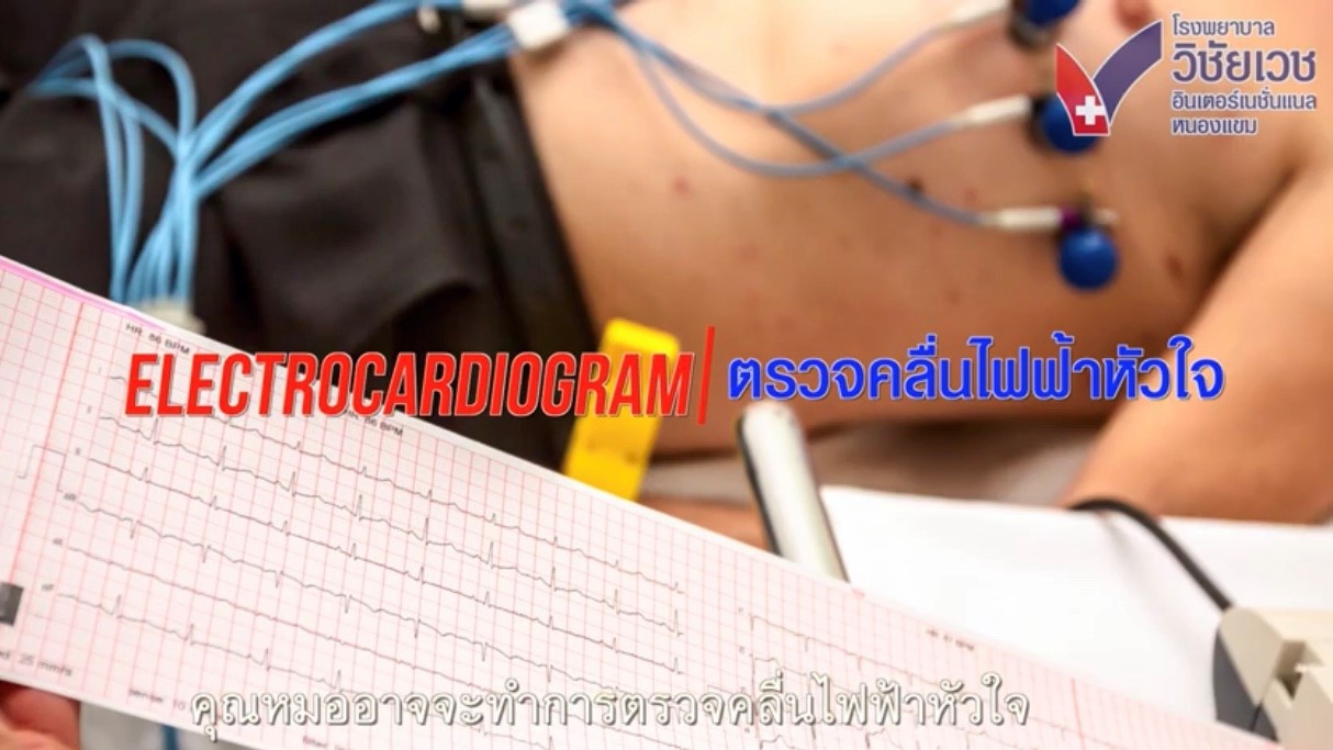 ตรวจคลื่นไฟฟ้าหัวใจ โดย ศูนย์หัวใจ วิชัยเวชฯ หนองแขม